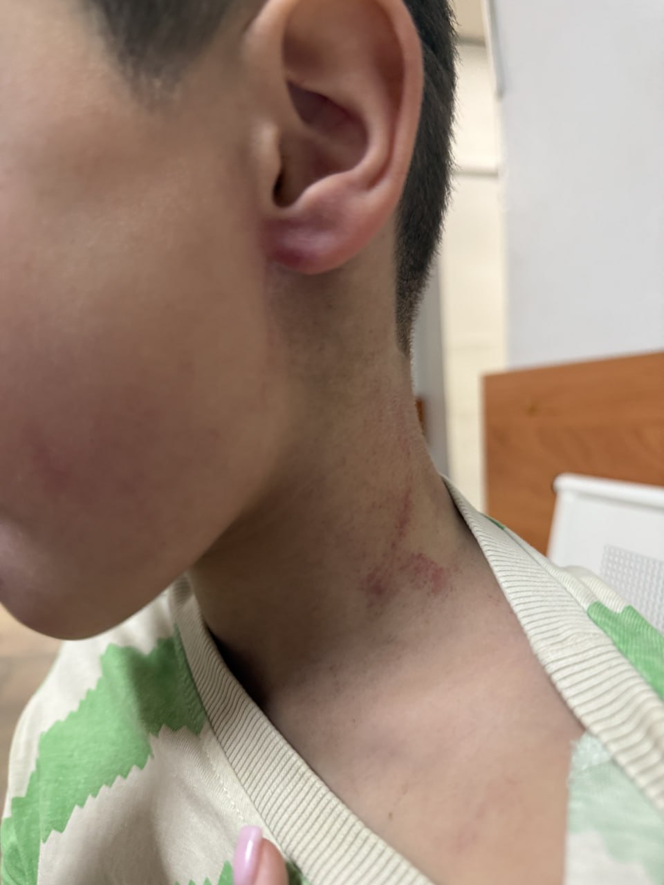 Тренер схватил ребёнка за шею и поднял в воздух в одном из детсадов Иркутска Инцидент произошёл 25 сентября в посёлке Молодёжный По словам матери учитель физкультуры схватил её сына за шею приподнял а затем оттащил за ухо в угол У ребёнка травмы головы лица шеи и ушей О случившемся воспитатели сообщили родителям только вечером Заявление в полицию подали сразу но тренер продолжал работать сообщает Межрегиональный центр по правам детей Следком и прокуратура начали проверки Межрегиональный центр по правам детей