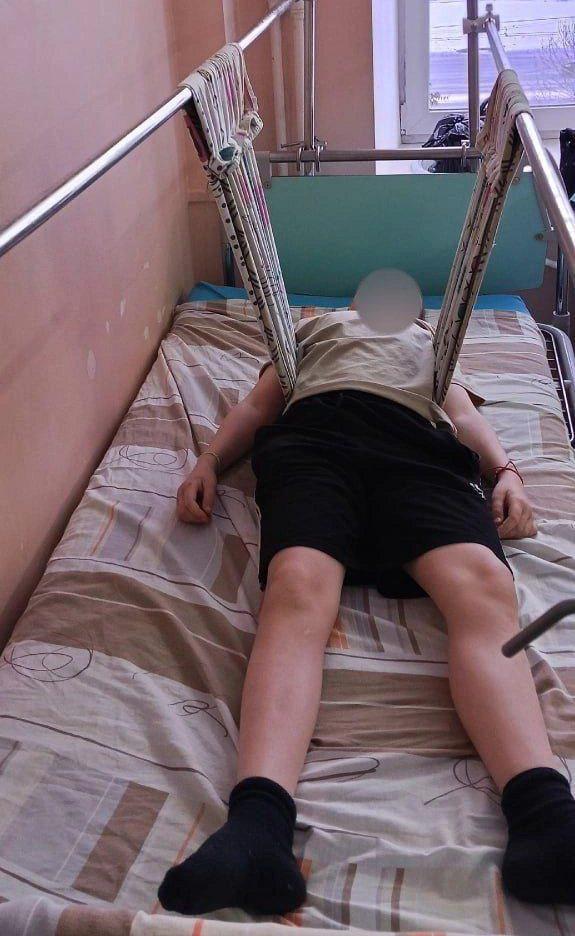 В Челябинске школьник сломал позвоночник катаясь с друзьями на горке Несчастный случай произошел еще 1 января в поселке Новосинеглазово 12 летний Володя катался с друзьями паровозиком подскочил на ледяном бугре и неудачно приземлился Теперь мальчик оказался на больничной койке в отделении травматологии ЧОДКБ История получила неприятное продолжение из за врачебной ошибки В первый день ребенка осмотрели в травмпункте ГКБ 9 и отправили домой не заметив тяжелой травмы Только на следующие сутки когда боли стали невыносимыми повторное обследование выявило перелом двух позвонков Сейчас школьнику нужен дорогостоящий корсет и долгая реабилитация Тем временем в дело вмешались силовики Полиция и прокуратура начали проверку уже известно что опасная горка была самодельной 74 RU УРАЛИТИ Мы в Max