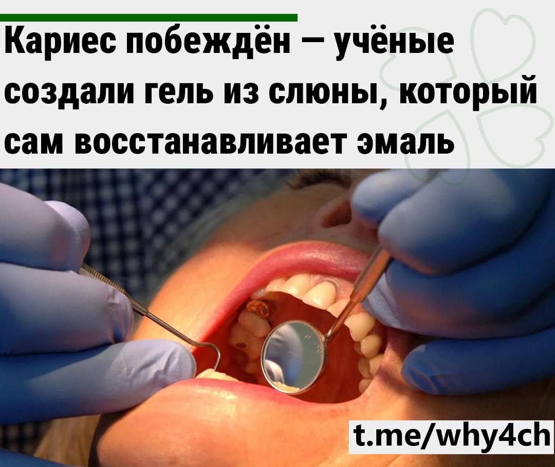 Кариес В С Ё Учёные Ноттингемского университета на основе натуральных компонентов слюны создали гель который сам восстанавливает эмаль Особый состав создаёт на зубах тонкий и прочный слой который держится несколько недель даже во время чистки зубов Полноценные испытания на людях в следующем году а готовый продукт обещают к концу 2026 го