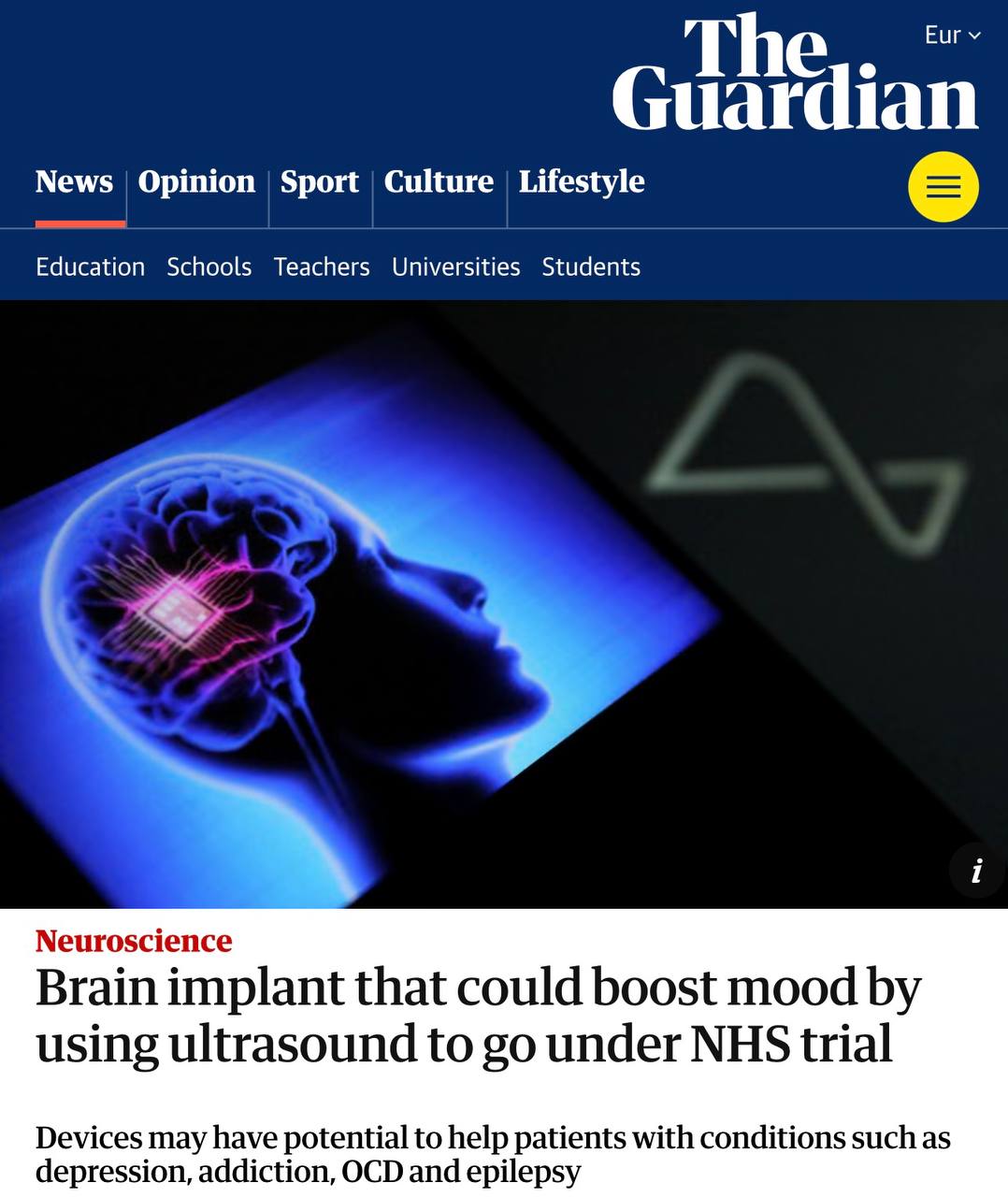 Ученые испытают мозговой имплантат, который поможет повысить настроение с помощью ультразвука  В исследовании, финансируемом Британским агентством перспективных разработок и изобретений  Aria , примут участие 30 пациентов. Наблюдения за ними будут вести в течение трех с половиной лет.   В Aria отметили, что для эксперимента ученые отобрали людей с черепно-мозговой травмой. То есть тех, у кого была временно удалена часть черепа. Чип поместят в углубление на коже головы, поэтому пациентам даже не потребуется хирургическое вмешательство, рассказали эксперты The Guardian.  Отмечается, что устройство, разработанное американской некоммерческой организацией Forest Neurotech, использует ультразвук для считывания и изменения активности нескольких участков мозга одновременно.  Эксперты считают, что такой чип в будущем поможет людям с депрессивными расстройствами, зависимостями, ОКР и эпилепсией