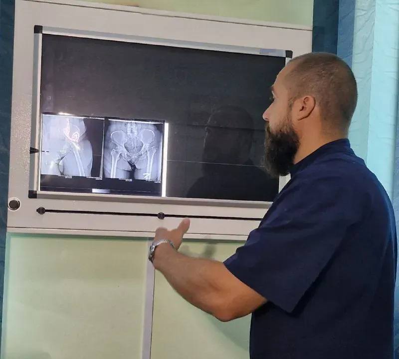 Операции по замене коленных и тазобедренных суставов доступны в Амурской области На нее в этом году запланировано более 7 0 0 пациентов Благодаря процедуре эндопротезирования медики Амурской областной и Благовещенской городской больниц дают шанс жителям Приамурья передвигаться свободно и без боли Такая помощь очень востребована в наши дни так как коленные и тазобедренные суставы изнашиваются и повреждаются чаще Причиной этому может быть образ жизни и наличие заболеваний Как сообщает министерство здравоохранения Амурской области в 2025 году запланировано более 700 пациентов на операцию по эндопротезированию Все это благодаря государственной программе бесплатного оказания высокотехнологичных видов медицинской помощи Травматологи с современным оборудованием выявляют степень патологии и выявляют риски возможных заболеваний Подробнее