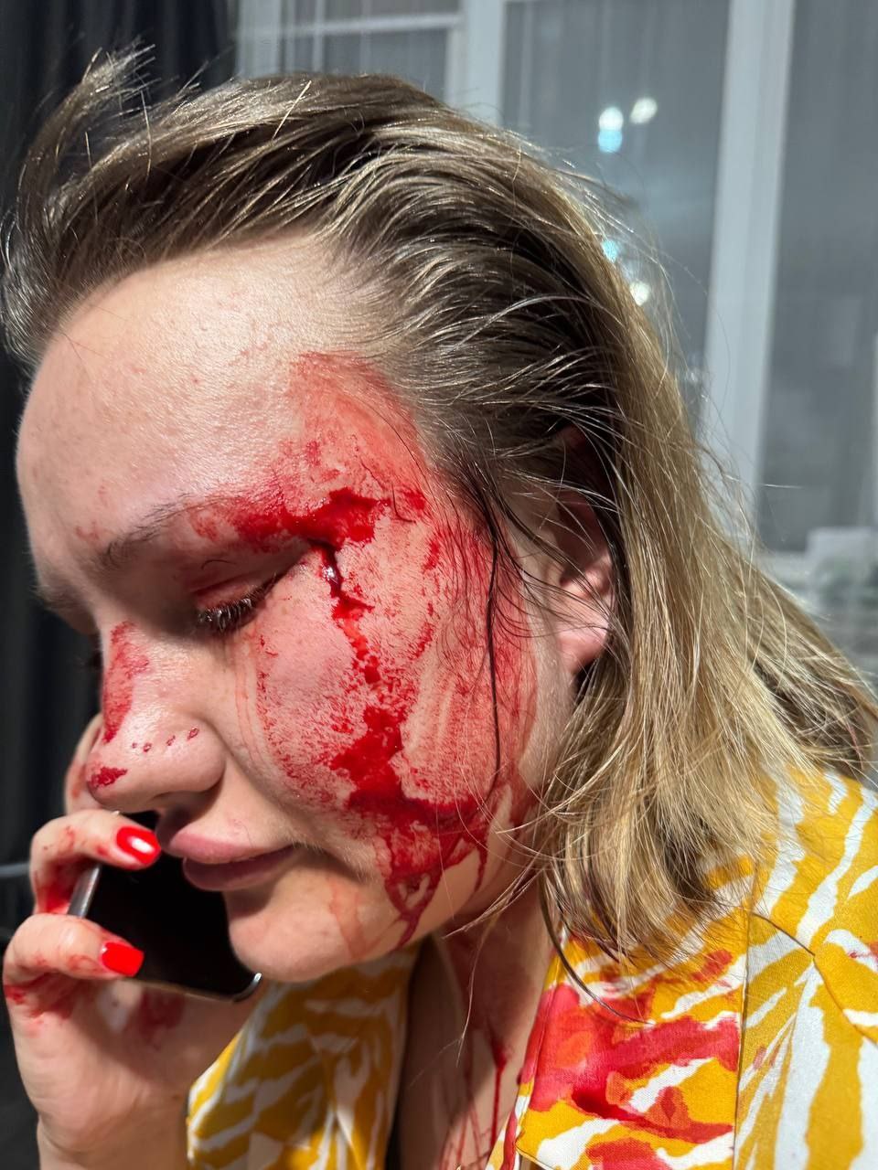 Пожалуйста, я прошу о помощи, я прошу общественной огласки, так как полиция бездействует: во Владивостоке девушку жестоко избил бывший В ночь на 12 июня на Красного Знамени, 133/3, жительница Владивостока подверглась жестокому избиению. По её словам, бывший молодой человек ворвался в квартиру и начал избивать её по голове без разговоров и причин. Девушка утверждает, что теряла сознание, у неё рассечён висок, множественные шишки и синяки, наложено три шва. Когда нападавший остановился, его друг, оставшийся за дверью, вытащил его из квартиры и оказал девушке первую помощь. Потерпевшая вызвала скорую и полицию. Медики приехали быстро — но полицейские так и не приехали ни ночью, ни на следующий день. В отделении на Махалина ей сказали «ждать», потому что участковый — в отпуске. За четыре дня никто не опросил ни её, ни свидетелей, ни даже соседей. «Он бил меня по голове и говорил: “Сдохни, тварь. Можешь хоть заявление пиши — мне ничего не будет”», — рассказала пострадавшая.