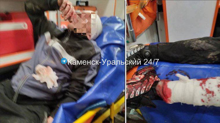 Бойцовские собаки искусали мужчину в Каменске-Уральском после конфликта возле магазина Ночью супружеская пара шла в круглосуточный магазин, где столкнулась с другой парой, выгуливающей шарпея и стаффордширского терьера. Между ними разгорелся конфликт, переросший в драку. По словам пострадавших, девушка, хозяйка собак, спустила их с поводков и скомандовала «фас». Животные набросились на мужчину и покусали лицо, бок и ноги. Пострадавшего госпитализировали и наложили швы. «Мужчина госпитализирован с тяжелыми травмами, включая множественные укусы и серьезные повреждения ноги. Хозяйка с собаками скрылась», — сообщает telegram-канал «Каменск-Уральский 24/7» и публикует фото. По другой версии, конфликт начался с того, что хозяйка собак ударила жену пострадавшего, после чего мужчины, сопровождавшие её, напали на мужа, затем последовала команда «фас». После нападения хозяйка собак скрылась с места происшествия. Сейчас правоохранительные органы разыскивают владельцев животных. Новости Екб тут