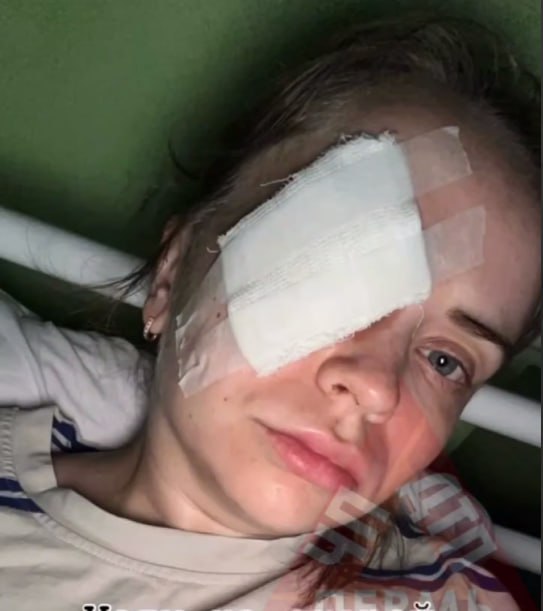 Пермячка получила серьезную травму глаза, просто бегая в парке. Девушка утверждает, что в нее стреляли. Как сообщают соцсети, это случилось минувшим вечером в сквере на ул. Макаренко у АЗС «Лукойл». Как пишет сама пострадавшая, во время тренировки ей резко стало плохо, потемнело в глазах, пошла кровь. Скорую вызвали катающиеся на экстрим-площадке ребята. По словам спортсменки, уже в больнице выяснилось, что в глаз попала пуля от пневматики. Ей оказали медицинскую помощь. Сейчас девушка ищет очевидцев произошедшего. Как сообщили порталу Propem.ru в полицейском главке,16 июня, действительно, в отдел полиции Мотовилихинского района поступило сообщение от жительницы города 1995 г.р. о том, что неизвестный травмировал ей глаз. По данному факту проводится проверка, устанавливаются все обстоятельства случившегося. Изображение: фото ЧП ДТП. Дорогие друзья, берегите себя…