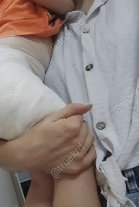 Полуторагодовалая девочка получила химический ожог в детском саду в Сочи Сотрудники ПДН разбираются при каких обстоятельствах ребенок получил травму Сейчас девочка находится дома ее жизни ничего не угрожает сообщили в полиции truekrd Кубань 24 в MAX