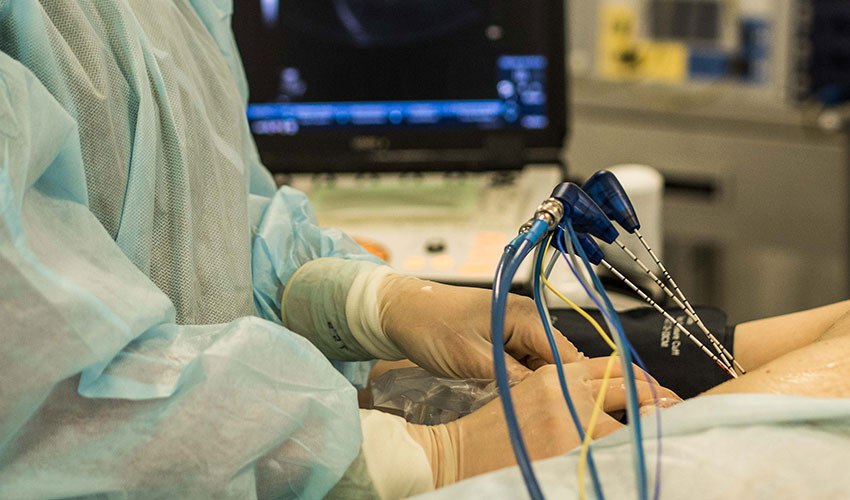 РАЗРАБОТАН ПЕРВЫЙ В СТРАНЕ КОМПЛЕКС ДЛЯ УНИЧТОЖЕНИЯ РАКА МИКРОВОЛНАМИ В Новосибирске разработали первый в стране комплекс который позволит уничтожать опухоли без открытой операции под воздействием микроволнового излучения Прототип уже успешно прошел лабораторные испытания Устройство можно применять для лечения при раке груди щитовидной железы новообразованиях в легких почках и печени Продолжительность процедуры 20 минут вместо часа при удалении опухолей с помощью традиционной операции Разработанная технология позволяет воздействовать на участки размером от 6 5 мм до 70 мм Принцип работы комплекса основан на том что в опухоль вводят антенну подключенную к микроволновому генератору Она направленно излучает электромагнитную энергию нагревающую молекулы воды в тканях При достаточно высокой температуре пораженные участки начинают разрушаться При этом структуры за пределами заданной области не подвергаются чрезмерному термическому повреждению Источник Новосибирские новости времявперёд