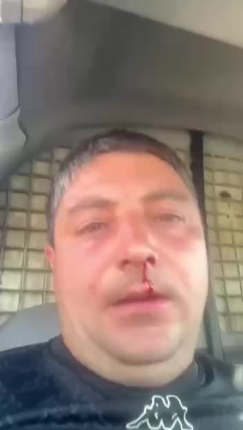 Инцидент в Богиченах: советник PAS избил представителя ЕСДП