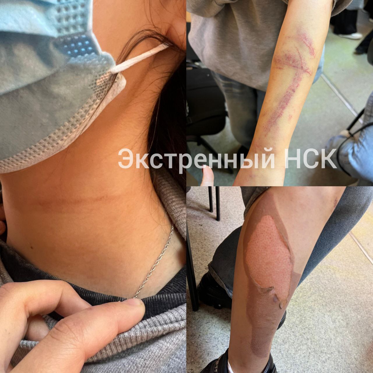 Пытал раскалённым утюгом  В Октябрьском районе Новосибирска 18-летний парень едва не расправился со своей знакомой девочкой-подростком.   Что именно между ними произошло, выясняют следователи комитета.  Возбуждено уголовное дело по статье покушение на убийство.   Насколько известно, жестокий юноша после применения бытового прибора, так вошёл во вкус, что в порыве ярости душил подружку, пинал и добивал палкой.  Потерпевшая выжила чудом. В конфликт успели вмешаться соседи.   Агрессора отправили в изолятор.   Фото СУ СКР НСО