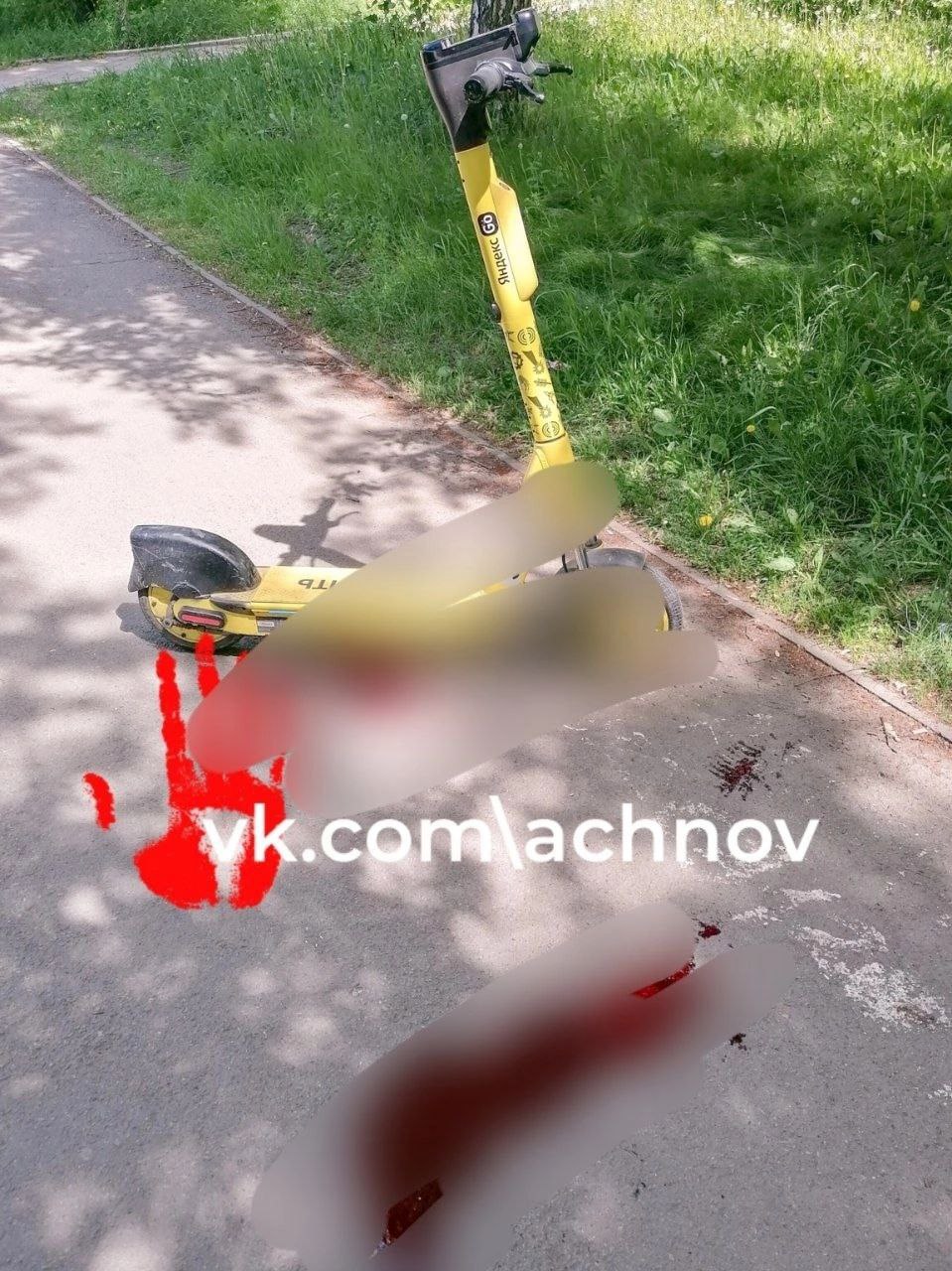 В Челябинске, после того, как 18-летний парень сбил 78-летнюю женщину, возбудили уголовное дело Расследование начато в рамках статьи 238 УК РФ "Производство, хранение, перевозка либо сбыт товаров и продукции, выполнение работ или оказание услуг, не отвечающих требованиям безопасности". ‼ Глава СКР дал поручение и.о. руководителя СУ СК России по Челябинской области Шавкунову доложить о ходе движения дела и установленных обстоятельствах происшествия. Напомним, речь об аварии на улице Горького. Агентство чрезвычайных новостей Челябинск писало об этом вчера. В ГИБДД сообщили, что молодой человек управлял самокатом Яндекс GO. Пенсионерка, которую он сбил, с серьёзными травмами была госпитализирована. Ранее: vk.com/wall-57604288_2212462