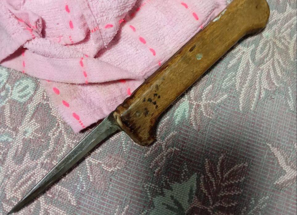 В Ялте перед судом предстанет женщина, ударившая ножом сожителя. 44-летняя женщина, находясь в состоянии алкогольного, в ходе конфликта с сожителем нанесла ему кухонным ножом удар в область живота. Она была задержана сотрудниками полиции. Уголовное дело направлено в Ялтинский городской суд для рассмотрения по существу.