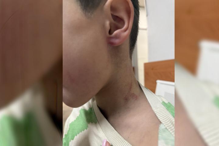 Схватил за шею и поднял в воздух тренер жестоко обращался с ребенком в детском саду Иркутского района В одном из детских садов поселка Молодежный Иркутского района разгорается скандал В социальном учреждении тренер по физкультуре нанес множественные телесные повреждения ребенку По словам обеспокоенной матери ее сын посещающий детский сад получил серьезные травмы головы лица шеи и ушей Тренер схватил мальчика за шею поднял его в воздух а после оттащил за ухо в угол рассказали в пресс службе центра О случившемся родители узнали лишь вечером 25 сентября когда все и произошло от воспитателя детского сада Как утверждает мать пострадавшего ребенка тренер продолжает работать в детском саду а администрация учреждения пытается оправдать его действия Межрегиональный центр по правам детей намерен добиваться уголовного преследования тренера СК завел уголовное дело по статье Неисполнение обязанностей по воспитанию несовершеннолетнего Региональная прокуратура проводит проверку