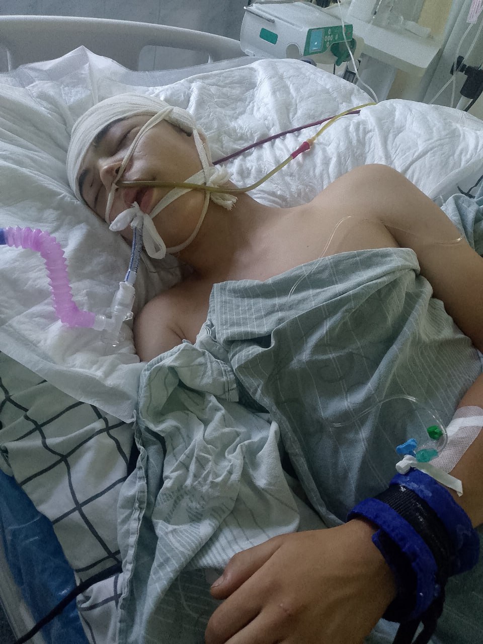 В Башкирии 17-летний подросток попал в кому после жестокого избиения. Семья ищет деньги на адвоката и лечение Трагедия произошла в селе Юмагузино Кугарчинского района. По словам родных, 17-летний Рузиль был жестоко избит в ночь с 14 на 15 июля. Парень — самый старший сын в семье, где воспитываются еще семь детей. Родные юноши уверены — преступление было запланировано и у него есть мотивы. «Приехали вчетвером, выманили из дома. Били двое. Он их точно знал. Это была месть за то, что Рузиль встречается с девушкой, которая раньше была с другим. Эти же люди терроризируют все наше село, они на свободе, а полиция бездействует. У сына перелом черепа, кровоизлияние в мозг, он девятый день в коме», — рассказал UTV отец пострадавшего. Чтобы собрать доказательства, семья намерена обратиться в суд. По их словам, им необходимо минимум 1,8 млн рублей на помощь адвоката, проведение независимой экспертизы, а также сбор доказательств и поездки. В Следкоме Башкирии по данному факту возбуждено уголовное дело по ст. 111 УК РФ умышленное причинение тяжкого вреда здоровью . О расследовании доложено в центральный аппарат ведомства. Фото предоставлено семьей пострадавшего.