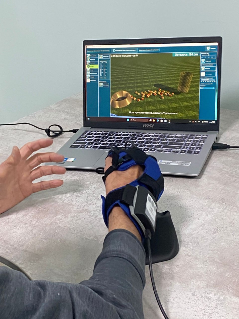 В отделении амбулаторной медицинской реабилитации городской клинической больницы 11 появилось роботизированное оборудование для реабилитации Тренировки с применением оборудования не только укрепляют мышцы но и помогают мозгу восстанавливаться Оборудование планируют использовать в том числе для реабилитации участников СВО Один из применяемых приборов для реабилитации умная перчатка отечественного производства которая развивает мелкую моторику рук и координацию движений Перчатка улучшает суставную подвижность уменьшает спастичность повышенный тонус мышц который приводит к двигательным нарушениям увеличивает мышечную силу кисти нормализует психоэмоциональный статус Подписывайтесь на канал РИА Воронеж в Max