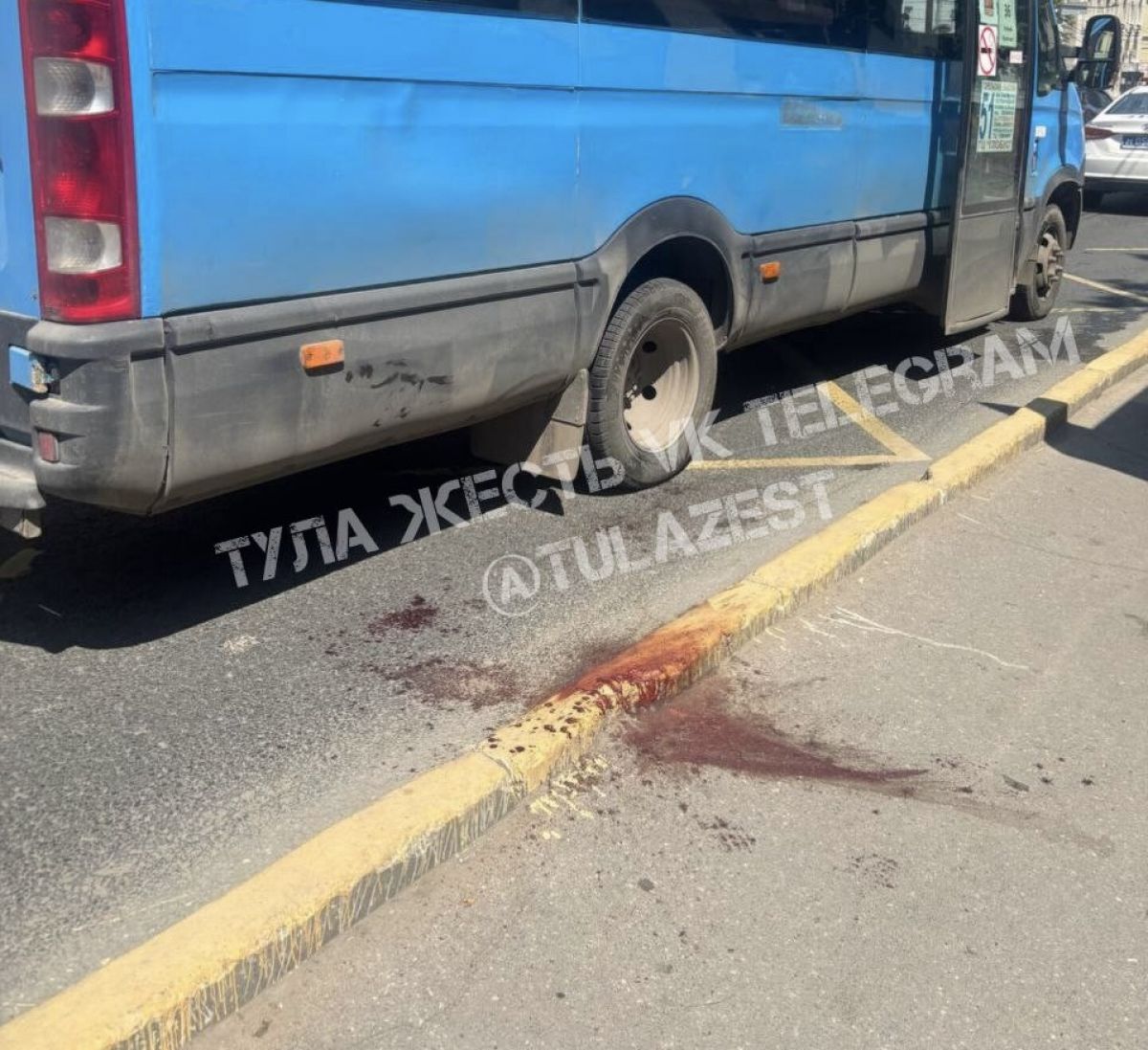 В Туле 87-летняя женщина пострадала выходя из общественного транспорта В Туле 87-летняя пенсионерка пострадал выходя из автолайна. Туляки заметили лужу крови рядом с месте падения. ↗ Прислать новость Подписаться