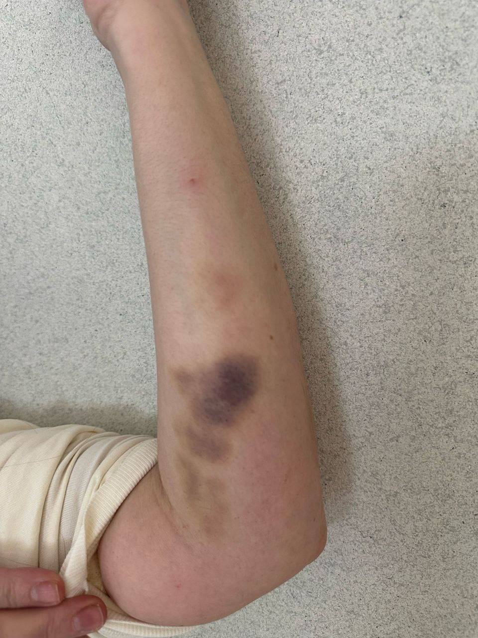 Во Владивостоке избили девушку, но полиция встала на сторону нападавшего со «связями»  На улице Южно-Уральской мужчину на Toyota Mark II возмутил отказ девушки от знакомства — он набросился на неё, избил, вырвал волосы и забрал телефон. Девушка успела всё зафиксировать на видео. Позже он ворвался в отдел полиции, где она пыталась подать заявление, и вновь угрожал — сотрудники не вмешались.  У девушки диагностировали сотрясение и ушибы. Несмотря на видео, отпечатки и показания, в возбуждении дела отказали.  Пострадавшая: «Меня избили, но полиция встала на его сторону. Я одна против системы».