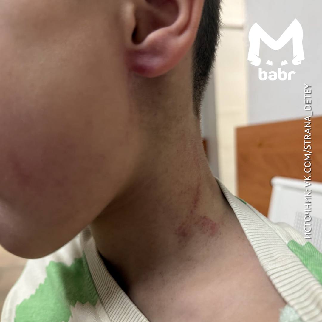 Учитель физкультуры схватил ребёнка за шею и поднял в воздух в детсаду Иркутской области Это случилось 25 сентября в посёлке Молодёжный После удушения тренер оттащил мальчика за ухо в угол Родителям о случившемся воспитатели сообщили только вечером Со слов матери у сына травмы головы лица шеи и ушей Заявление подали но мужчина продолжал работать а руководство садика пыталось его оправдать В ситуацию вмешался межрегиональный центр по правам детей Сегодня Следком возбудил уголовное дело о неисполнении обязанностей по воспитанию несовершеннолетнего Полиция проводит проверку Babr Mash