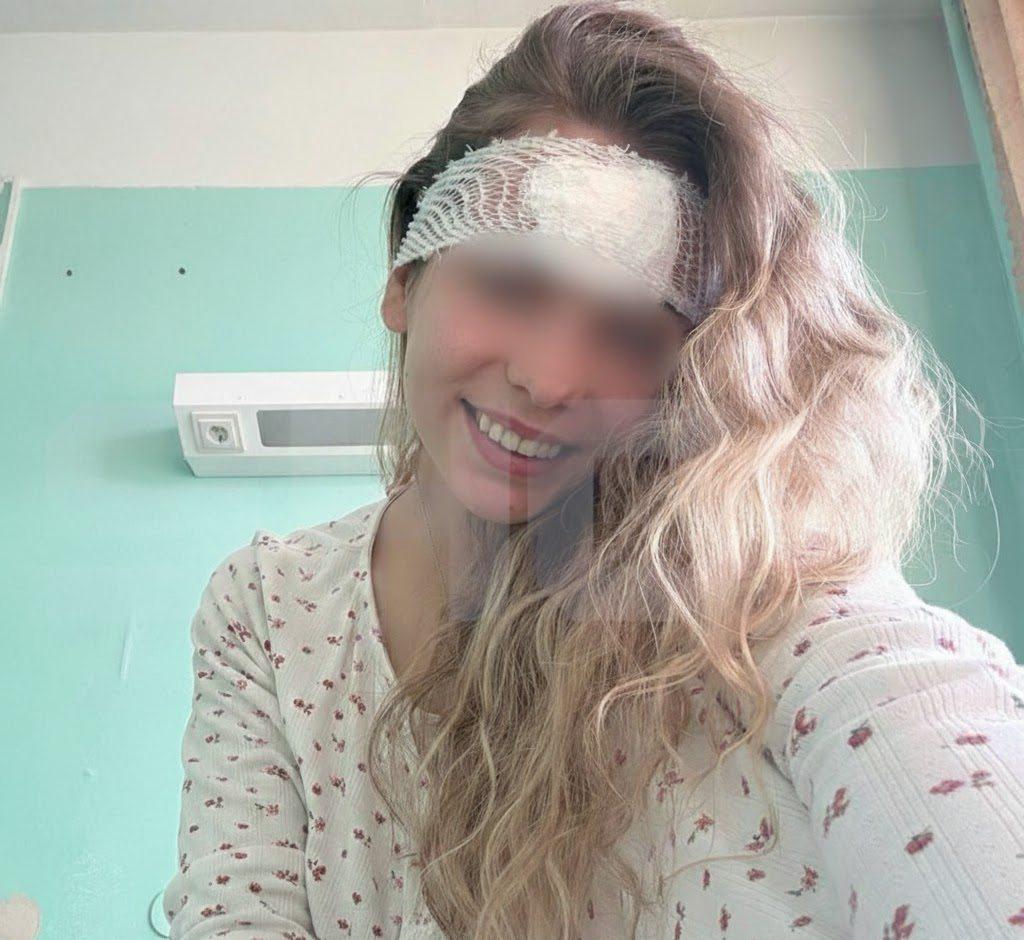 Жительницу Архангельской области госпитализировали после того как она выдавила прыщ на лице У 28 летней девушки начался сильный отёк и воспаление инфекция быстро распространилась и врачам пришлось экстренно разрезать лоб и назначить антибиотики Причиной осложнений стало попадание бактерий прыщ выдавливали грязными руками В итоге пациентку положили в больницу bezposhady