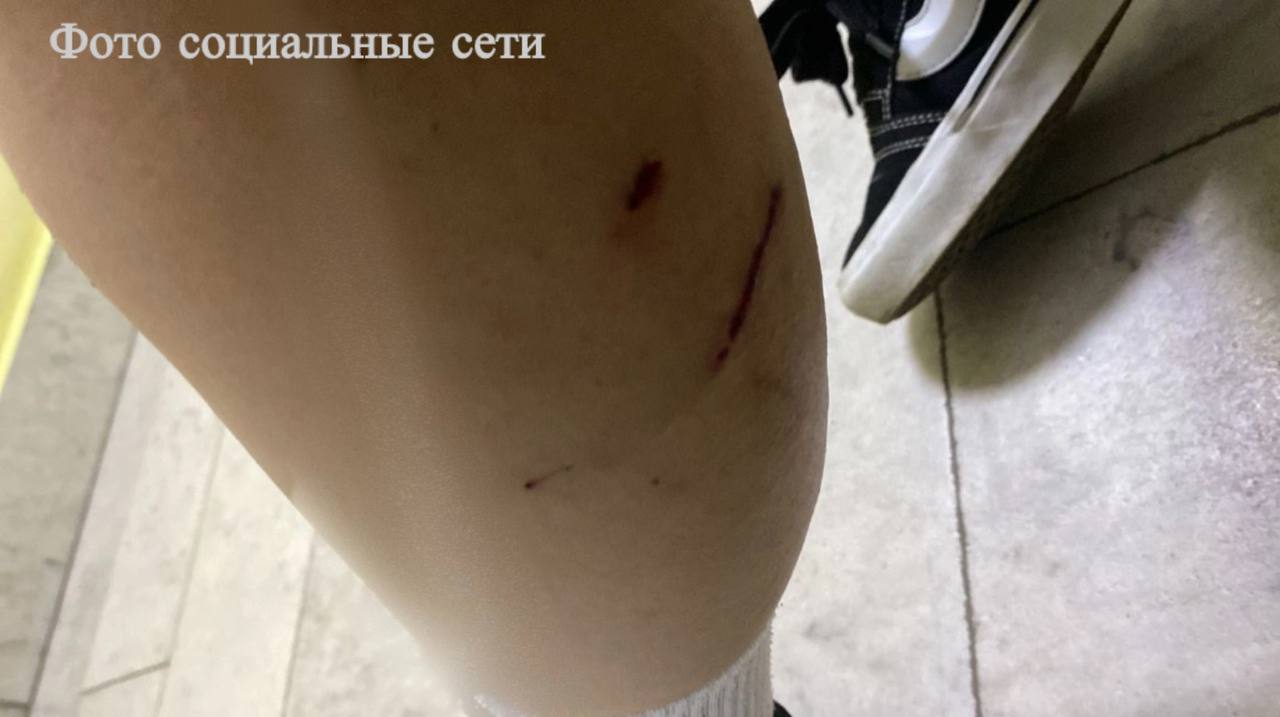 Бездомные собаки напали на 16-летнюю жительницу Минеральных Вод Информация о случившемся появилась в социальных сетях. После инцидента несовершеннолетней понадобилась медицинская помощь. Сейчас ее здоровью ничего не угрожает. По факту произошедшего Следком организовал проверку. По ее результатам будет принято процессуальное решение, сообщили в СУ СК России по Ставропольскому краю. / Все наши каналы