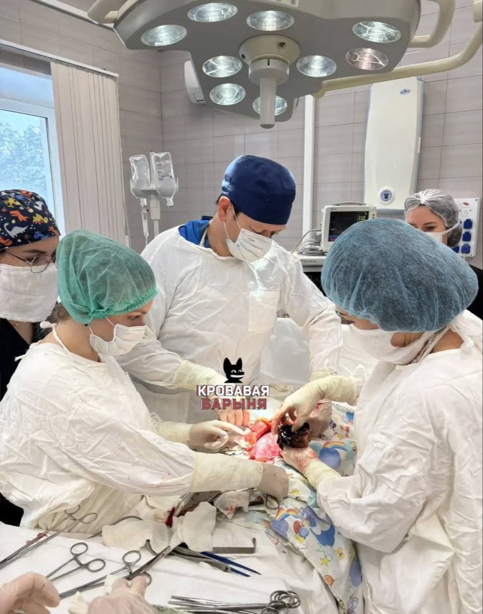 Ксения Собчак рассказала об уникальной операции в Перинатальном центре Калуги сохранившей беременность женщины 21 летняя пациентка поступила с жалобами на сильные боли живота Кисту в 10 см обнаружили позади увеличенной матки Операция осложнялась сроком беременности 27 недель весом плода около 1 кг необходимостью общей анестезии и высоким риском кровотечения Врачи удалили кисту используя щадящее хирургическое вмешательство сохранив при этом беременность пациентки сообщается на канале Кровавая барыня Наш канал в MAX