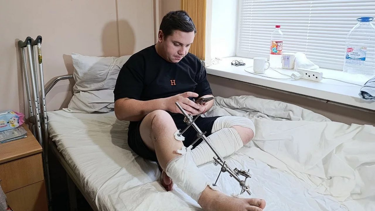 Челябинские хирурги спасли ногу многодетному отцу из Верхнего Уфалея Несчастный случай произошел в Верхнем Уфалее Мужчина получил перелом обеих костей голени из за обширной раны обнажились связки и кости Приехал с вахты стал готовить огород к зиме Посеял начал пахать мотоблоком И тут у него слетел ремень и меня под него зажевало Никого рядом не было хорошо что телефон был с собой Зажал рану как мог и терпел пока не приехала скорая рассказал пострадавший Первую помощь пациенту оказали в Верхнем Уфалее стабилизировали состояние и кости чтобы не допустить смещения отломков Затем на вертолете его экстренно доставили в Челябинск в областную клиническую больницу Перед тем как начать восстанавливать кости ноги необходимо было решить проблему с огромной раной Пока кожная рана не заживет кости нормально не срастутся Либо если бы присоединилась инфекция нагноение мог бы встать вопрос об ампутации голени Лечение мы проводили совместно с травматологами Они установили устройство для фиксации отломков Мы сделали пересадку тканей с брюшной стенки и этим ускорили процесс лечения поясняет заведующий отделением реконструктивной и пластической хирургии ЧОКБ Юрий Васильев В итоге операция в которой участвовали более 10 человек прошла успешно Благодаря работе врачей из Верхнего Уфалея их коллег из Челябинска а также санитарной авиации позволившей оперативно перевезти пострадавшего у южноуральца появился реальный шанс полностью восстановить двигательную функцию даже после такой тяжелой травмы Фото пресс служба ЧОКБ Подписывайтесь на Вести Южный Урал в MAХ