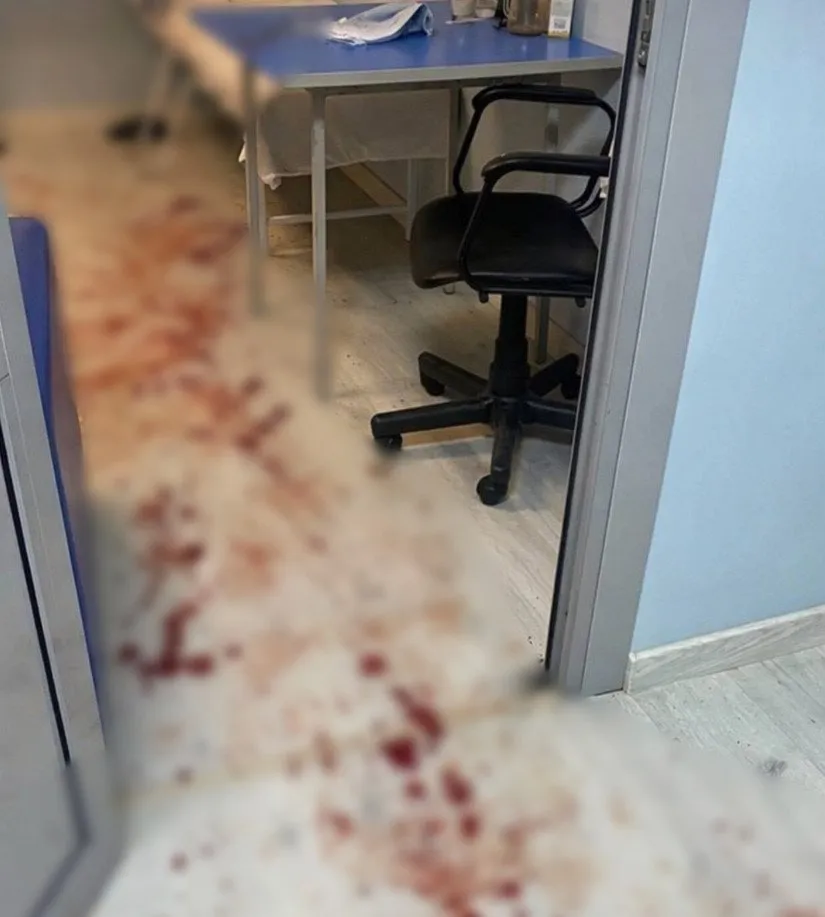 Мужчина устроил поножовщину в дагестанской больнице Злоумышленник ранил двух сотрудников Республиканской клинической больницы им Вишневского в Махачкале травматолога и хирурга Об этом сообщили в Минздраве региона Один из пострадавших находится в реанимации По данным СМИ мужчина разозлился на персонал больницы из за того что его родственнику вовремя не оказали помощь Опасного посетителя задержала охрана учреждения Его уже передали полиции По факту случившегося возбуждено уголовное дело   Подпишитесь на Абзац в Максе