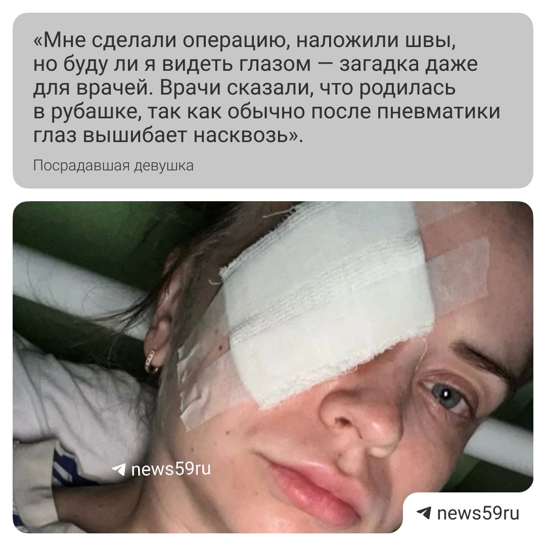Девушка получила пулю в глаз по время пробежки в парке «Макаренко». Пострадавшая написала заявление в полицию и ищет очевидцев. Инцидент произошел 16 июня около 19 часов — пермячка пробегала мимо местной заправки и почувствовала сильную боль в глазу. Прохожие вызвали ей скорую помощь. Медики нашли в глазу девушки пулю от пневматического пистолета. Пермячку госпитализировали, она до сих пор лежит в больнице. Сможет ли она видеть этим глазом, пострадавшая пока не знает. Если вы были очевидцем случившегося, свяжитесь с редакцией: . Подписаться Прислать новость