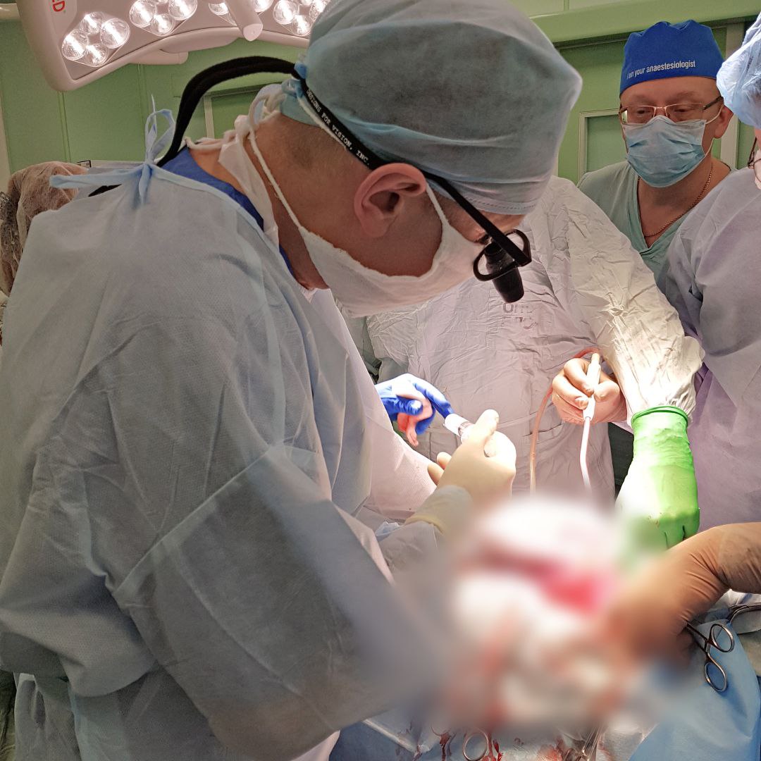 Команда врачей Первой городской больницы имени Е.Е. Волосевич провела первую в этом году трансплантацию почки. Специалисты добавили 37-летней архангелогородке к родным больным почкам третью – здоровую. Впереди пациентку ждет восстановление, итогом которого станет полноценная и комфортная жизнь без постоянной привязки к аппарату гемодиализа. Надежда сможет вернуться к привычному образу жизни, в которой больше не будет процедур. На сегодняшний день Первая городская больница имени Е.Е. Волосевич – единственное медучреждение региона, в котором пересаживают донорские органы. За время действия профильной программы проведено 28 операций. В планах врачей на этот год выполнить еще 14 операций по пересадке почек и печени. Наша задача – приблизить помощь к каждому пациенту, развивая трансплантационную службу Поморья. Это одно из важнейших направлений реализации президентского нацпроекта «Продолжительная и активная жизнь» в нашем регионе.