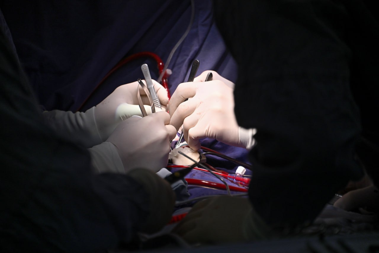 Впервые на Дальнем Востоке якутские врачи провели селективную плазмосорбцию билирубина В отделении анестезиологии реанимации и интенсивной терапии Якутского онкологического диспансера впервые проведена уникальная медицинская процедура селективная плазмосорбция билирубина Это современный метод внепочечного очищения крови который помогает удалять из плазмы токсины продукты воспаления и вредные вещества накапливающиеся при тяжелых заболеваниях Для проведения процедуры был установлен первый и пока единственный на территории Якутии аппарат который освоили специалисты диспансера Методика позволяет отделять плазму крови пропуская её через специальный сорбционный фильтр задерживающий вредные компоненты после чего очищенная плазма возвращается обратно пациенту Как рассказал заведующий отделением Николай Ефимов уже в ходе первого сеанса уровень билирубина у пациента снизился почти в два раза что подтверждает высокую эффективность метода Это значительный прорыв в развитии медицины региона и важный этап реализации национального проекта Продолжительная и активная жизнь Глава Якутии Айсен Николаев отметил что успех процедуры свидетельствует о профессионализме местных врачей и открывает новые возможности для качественного лечения теперь не требующего выезда за пределы республики