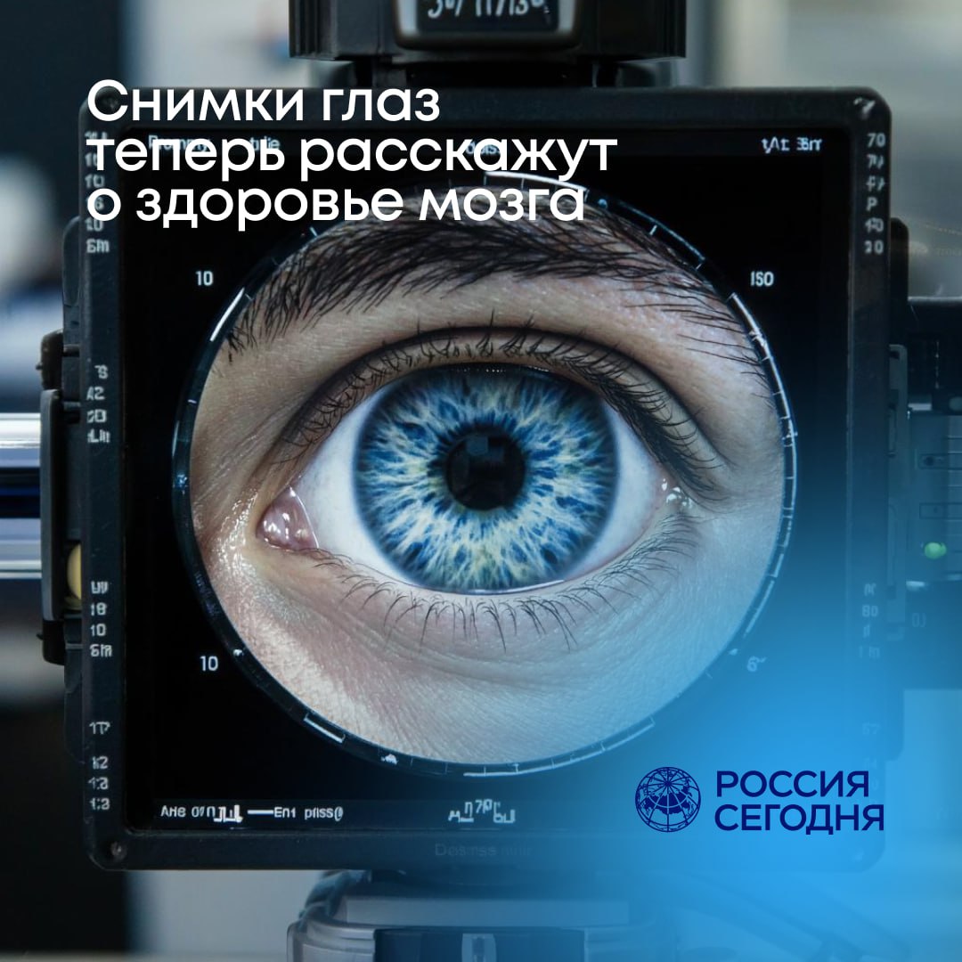 Разработан инновационный метод диагностики неврологических расстройств с помощью анализа изображений сетчатки Учёные urfu ru совместно с международным научным коллективом представили новую технологию диагностики таких заболеваний как синдром дефицита внимания и гиперактивности СДВГ расстройство аутистического спектра и болезнь Паркинсона посредством анализа изображений сетчатки глазного дна Методика базируется на применении технологий искусственного интеллекта и обеспечивает оперативность и экономичность процедуры диагностики По мнению исследователей Центра Искусственный интеллект разработанный подход позволит существенно сократить время постановки диагноза и облегчить работу медицинских специалистов за счёт автоматизации процесса анализа данных Наука на Урале
