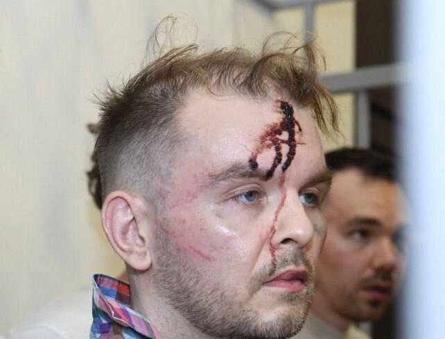 Отличник в школе и вузе, с криминалом не связан. Знакомые рассказали Daily Storm о Валерии Дулове — одном из задержанных в Баку россиян. Местные силовики подозревают мужчину в участии в ОПГ.  «Удивлен, что он оказался в этой ситуации. Думаю, все обвинения со стороны Азербайджана по поводу наркотиков — бред. Валера никогда такими делами не занимался. Это просто политическая история. Когда Алиев в связи с последними событиями просто заложников нахватал под надуманным предлогом», — cообщил Максим, одноклассник Дулова.  Собеседник назвал знакомого «хорошим, нормальным парнем».  «Он трудяга. Никогда не было с ним проблем. Помню, что и учился он хорошо. Хулиганом он не был точно! А в Азербайджан, допускаю, что он свалил в 2022 году из-за угрозы попасть под мобилизацию. Жизнь у всех по-разному складывается. Ну вот он вместо СВО в Азербайджане оказался...» — добавил он.  Валерия, однокурсница Дулова, также отозвалась о нем с положительной стороны.   «С ним мы вместе учились в Архангельском государственном техническом университете. Ничего плохого о нем сказать не могу. Очень добрый, отзывчивый человек. Учился в вузе на отлично. Но последние годы мы не общались с Валерой. Если честно, я в шоке», — призналась девушка.  Всего в Баку арестовали восьмерых россиян по делу о транзите наркотиков из Ирана и кибермошенничестве. О Дулове известно, что ему 38 лет и он родом из Архангельска. Ранее мужчина работал в компаниях «Роснефть» и «Газпромнефть», пишет Baza. По данным канала, Дулов покинул Россию в октябре 2022 года — он пересек границу с Казахстаном.