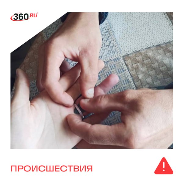 Палец ребенка застрял в кольце. На помощь пришлось звать спасателей.  Все произошло вчера в Сергиевом Посаде. Сотрудники «Мособлпожспаса»   приехали на вызов к 11-летней девочке. Проблема заключалась в том, что кольцо было керамическим и из-за этого его не получалось снять специнструментом или капроновой нитью.  Тем временем палец сильно опух: украшение передавило фалангу, а под ним образовалась ранка. В итоге кольцо аккуратно разбили слесарным инструментом и освободили руку. Ребенка передали медикам.