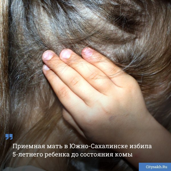 В Южно Сахалинске пятилетнюю девочку избили так что она попала в реанимацию Над ребенком издевалась приемная мать Следователи возбудили уголовное дело citysakh ru news 124956 Новости в MAX max ru citysakh только важное не тормозит купим ваши новости 79147662000