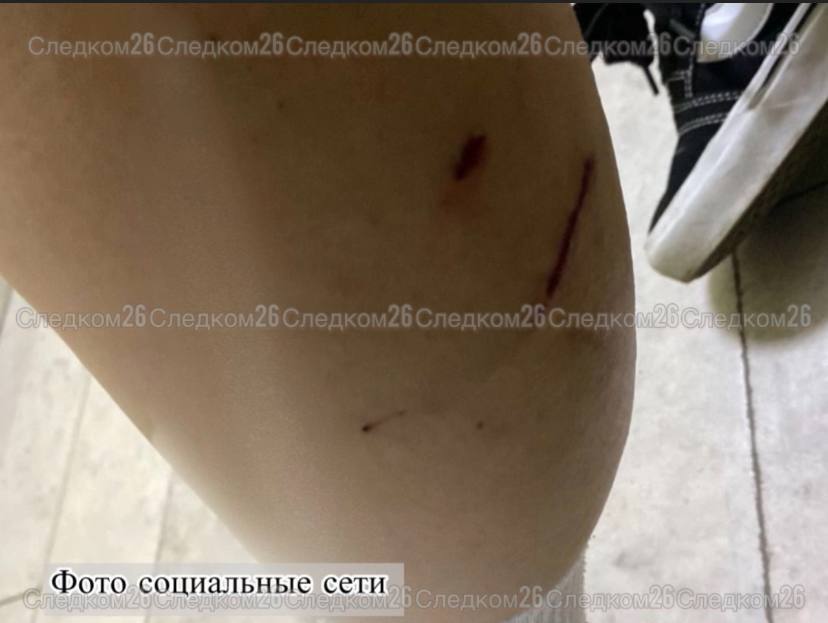 Бездомные собаки покусали девушку-подростка в Минводах. Животные напали на 16-летнюю девочку. Ей понадобилась медпомощь. Сейчас жизни и здоровью несовершеннолетней ничего не угрожает. Следователи проводят проверку по факту нападения собак, сообщили в управлении СКР по Ставрополью.