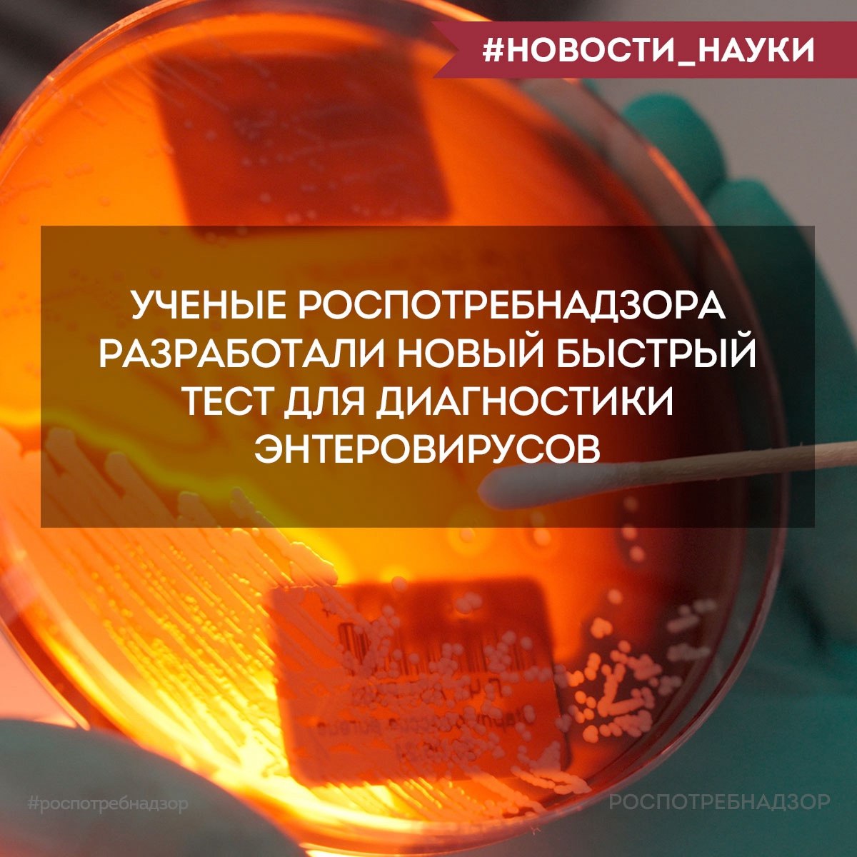 Роспотребнадзор VK Ученые ЦНИИ Эпидемиологии Роспотребнадзора разработали новый быстрый тест для диагностики энтеровирусов Энтеровирусы представляют собой группу вирусов способных вызывать разнообразные заболевания от легких респираторных и желудочно кишечных инфекций до серьезных состояний связанных с поражением центральной нервной системы Эти вирусы могут сохраняться в окружающей среде в том числе в сточных водах Новый тест позволяет всего за 3 0 минут проводить мониторинг окружающей среды на наличие этих возбудителей что значительно быстрее традиционных методов диагностики Он также обладает высокой специфичностью что критически важно для эпидемиологического надзора Разработка была осуществлена в рамках Федерального проекта Санитарный щит страны безопасность для здоровья предупреждение выявление реагирование