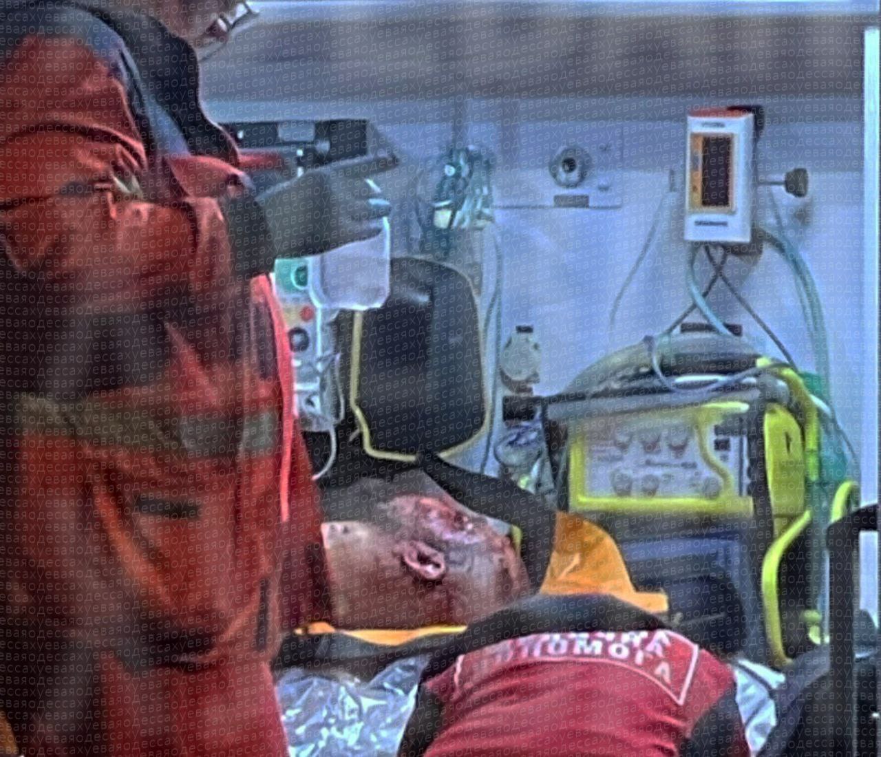 Действительно взрывная ссора Вполне ожидаемо виновником взрыва гранат в жилом доме в Одессе оказался боевик ВСУ Ну можно сказать что бывший поскольку мужик свалил из вийська в самоволку Да на беду свою решил заскочить к своей благоверной за кое какими вещичками Неизвестно из за чего между супругами вспыхнула ссора но очень быстро она достигла такого накала что явно неадекватный горе вояка использовал в ней в качестве аргумента две осколочные гранаты швырнув их жене в коридор В конечном итоге ему самому оторвало ногу вдобавок к множеству прочих тяжелых ран а женщине пальцы Также она получила множественные переломы и рваные раны лица Оба спорщика в тяжёлом состоянии отъехали в больничку А ведь по 404 й сотни тысяч таких субъектов бегают Подпишись RogandarNEWs мы в MAX