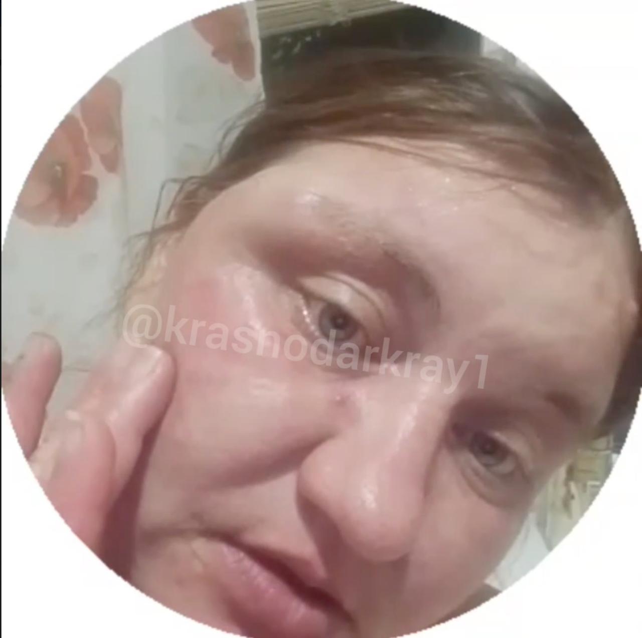 В Краснодаре возбудили уголовное дело после нападения на беремеменную женщину Напомним, что в ночь на воскресенье неизвестный мужчина ударил прохожую кулаком в висок, из-за чего у неё образовалась гематома под глазом. Дело квалифицировано как грубое нарушение общественного порядка, выражающее явное неуважение к обществу с применением насилия к гражданам. Нападавшему грозит до 5 лет лишения свободы. Сейчас полиция ищет злоумышленника. Фото: скриншот видео krasnodarkray1 Отправить новость Подписаться