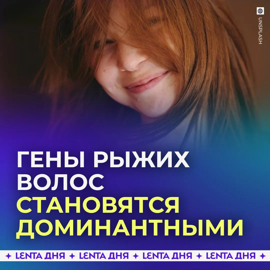 Рыжие люди захватят мир Гены связанные с рыжими волосами со временем вытеснят остальные так как являются более выгодными для выживания и размножения Учёные Гарвардского университета пришли к такому выводу изучив ДНК более 20 тысяч древних человеческих останков и современных людей Всего было обнаружено 479 генетических вариантов которым в разное время благоприятствовал естественный отбор Среди них также оказались гены связанные со светлой кожей непереносимостью глютена а также варианты снижающие вероятность диабета облысения и артрита По мнению учёнчых всего через несколько десятилетий рыжий цвет может стать доминантным во всём мире Подпишись на Ленту дня в МАКС Участвуй в розыгрыше