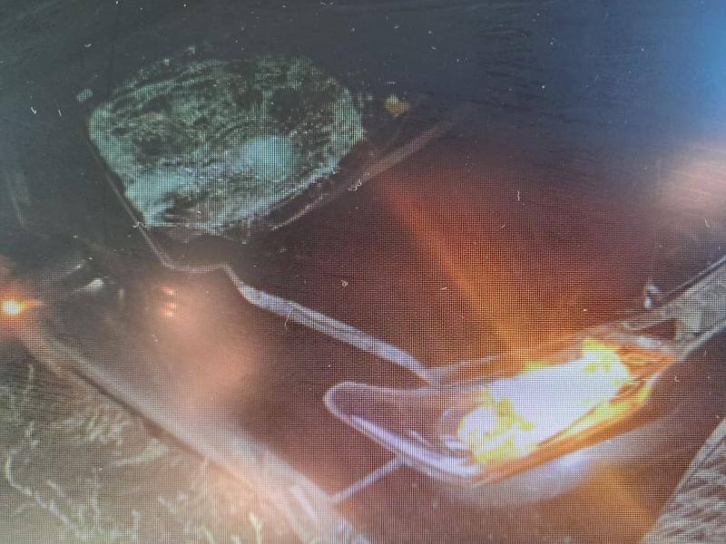 Вечером 2 сентября в Чите на улице Труда автомобиль сбил пешехода 43 летний мужчина получил травмы и госпитализирован Полиция проводит проверку для установления причин ДТП zabnews ru l 63755