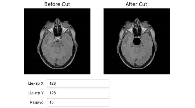 ИИ МРТ Магистранты института инженерно экономического и гуманитарного образования Иван Белов и Егор Бекиш создали программно исследовательскую платформу ДатаСкульпт на основе ИИ технологий для генерации и анализа синтетических МРТ снимков головного мозга Она предназначена для специалистов в области медицинских информационных технологий и позволяет обучать нейросетевые модели Руководитель проекта старший преподаватель кафедры Высшая математика Андрей Пенский В настоящее время ИИ разработки в области медицины имеют один нюанс доступ к МРТ данным для обучения и валидации систем диагностики существенно затруднен из за множества законодательных и этических ограничений Реальные данные недоступны и дороги а стандартные генеративные модели дают правдоподобные но клинически некорректные изображения без контроля патологий Сегодня нет инструмента который сочетал бы точную разметку этическую безопасность и давал бы возможность задавать тип локализацию и выраженность патологий Для решения этой проблемы политеховцы разработали программный прототип основу которого составили генеративные нейронные сети Их обучают на реальных медицинских изображениях и затем они создают новые синтетические МРТ снимки Специалисты из Самарского государственного медицинского университета предоставили нашим студентам необходимые данные для работы над проектом последовательные двумерные срезы головного мозга Уникальность политеховской платформы в сочетании генерации и автоматической проверки качества и структурной согласованности полученных изображений с использованием вычислительных и нейросетевых метрик Пользователь может управлять процессом генерации получать готовые данные и использовать их для обучения и тестирования других ИИ моделей в области анализа медицинских изображений Андрей Пенский Мы учим нейросеть создавать медицинские изображения похожие на реальные но не содержащие персональных данных пациентов говорит руководитель проекта Наша платформа решает проблему дефицита и труднодоступности медицинских данных при этом получаемые изображения отличаются разнообразием и могут включать признаки различных патологий что в дальнейшем позволяет использовать их для обучения диагностических ИИ систем Основная польза программы в возможности безопасно быстро и легально получать большие объемы данных для исследований и разработки медицинских технологий В разработке также принимали участие и другие студенты Иван Петров Ксения Горбатова Юлия Хабибуллина и Маргарита Шипилова МАХ ВК ДЗЕН