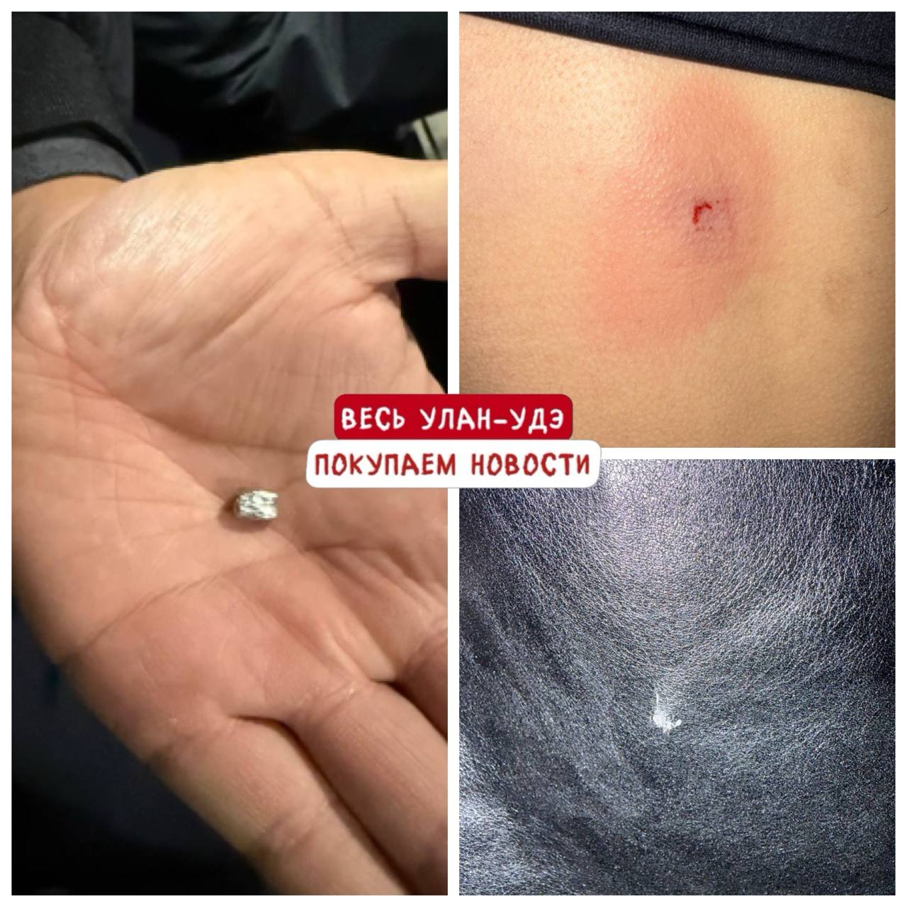 В Улан Удэ неизвестный выстрелил в 13 летнюю девочку с балкона Ребенок с собакой ждал маму во дворе дома на Микояна 3 Вдруг девочка услышала хлопок а затем ее пронзила боль в спине Выстрел произвели не из огнестрельного оружия пуля насквозь пробила кожаную куртку девочки на спине гематома На место прибыли полицейские и до ночи опрашивали местных Удалось установить что выстрел был сделан с балкона одного из соседних домов Связаться с нами можно через кнопку Написать нам Все объявления Бурятии здесь doska03bur