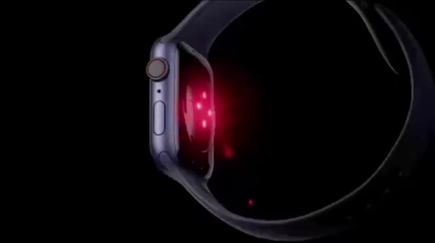 Аналитики указывают на погрешности в подсчете калорий Apple Watch