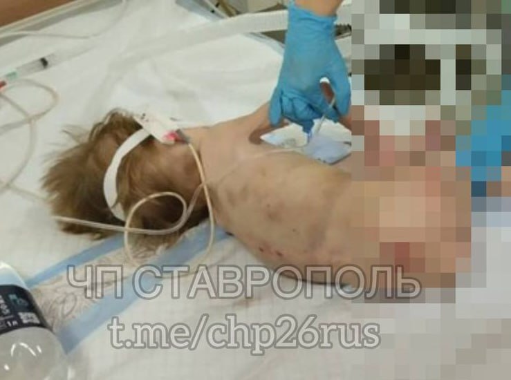 Истязавшая детей ставропольчанка предстанет перед судом Дело 27-летней жительницы с. Безопасного передали в суд. Как утверждают следователи и надзорники, жительница Безопасного больше месяца не кормила троих детей и применяла к ним физическое насилие. В январе 2025 года 4-летнего сына фигурантки в изможденном состоянии обнаружила тётя. Женщине инкриминируют умышленное причинение тяжкого вреда здоровью одного из малышей, средней тяжести вреда здоровью ещё двоим, а также неисполнение обязанностей по воспитанию несовершеннолетних. За всё это ей предстоит ответить перед судом. Фото: ЧП Ставрополь Stavropol.Media Прислать новость