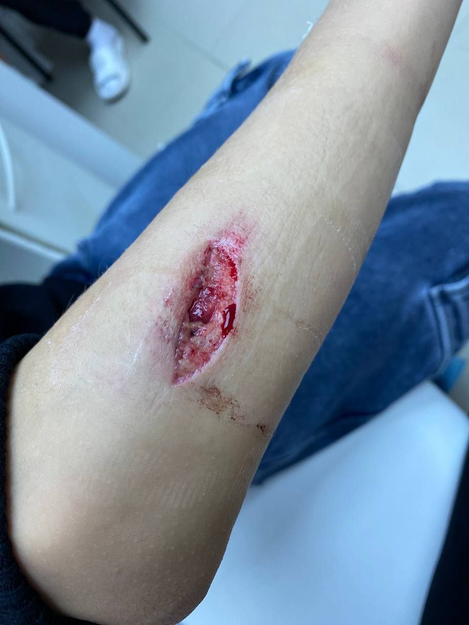 Вечерний Хабаровск Прокуратура проводит проверку по факту ненадлежащего оказания медицинской помощи ребенку в Фокино Приморского края Поводом для проведения проверки послужил сигнал из социальных сетей о том что в ночь на 8 января 2026 года в приемный покой учреждения здравоохранения обратился 12 летний мальчик с рваной раной предплечья и его законный представитель Однако в связи с отсутствием дежурного хирурга и отказом в транспортировке в Находкинскую городскую больницу надлежащая медицинская помощь малолетнему пациенту оказана лишь спустя более 6 часов Надзорное ведомство организовало проверку качества оказания медицинской помощи несовершеннолетнему по результатам которой будет принят комплекс мер подробнее на канале Вечерний Хабаровск