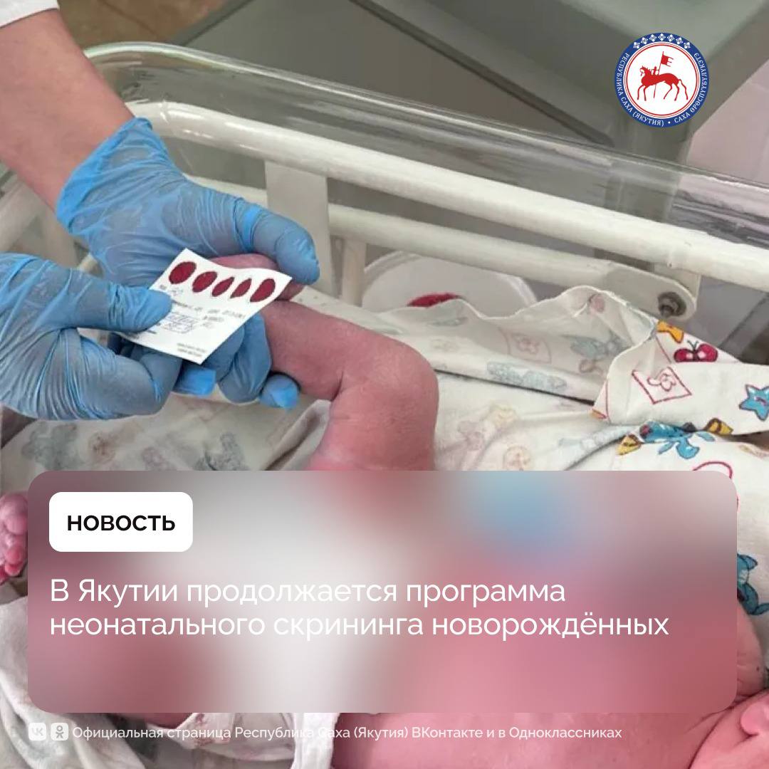 В республике активно проводится расширенный неонатальный — генетический скрининг новорождённых. По данным педиатров Минздрава республики, в 2024 году обследование прошли почти 10 тысяч малышей. За первые семь месяцев 2025 года скрининг проведён у 6002 детей. «Раннее обследование крайне важно, поскольку некоторые генетические заболевания проявляются уже в первые недели жизни. Неонатальный скрининг — это единственный способ своевременно обнаружить такие патологии и начать лечение», — отметила министр здравоохранения Якутии Лена Афанасьева. Обследование позволяет выявить такие заболевания, как фенилкетонурия, врождённый гипотиреоз, адреногенитальный синдром, муковисцидоз, галактоземия, спинальная мышечная атрофия СМА , первичные иммунодефициты ПИД и ряд наследственных нарушений обмена веществ. В регионе выстроены чёткие алгоритмы проведения исследования, а подтверждающая диагностика осуществляется на базе федеральных референсных центров. Расширенный неонатальный скрининг внедрён в Якутии с 2023 года по национальному проекту «Здоровье». В его рамках новорождённые проходят проверку на 36 заболеваний. Для этого в первые дни после рождения у ребёнка берётся анализ крови, позволяющий выявить врождённые и наследственные патологии. #ПравительствоЯкутии