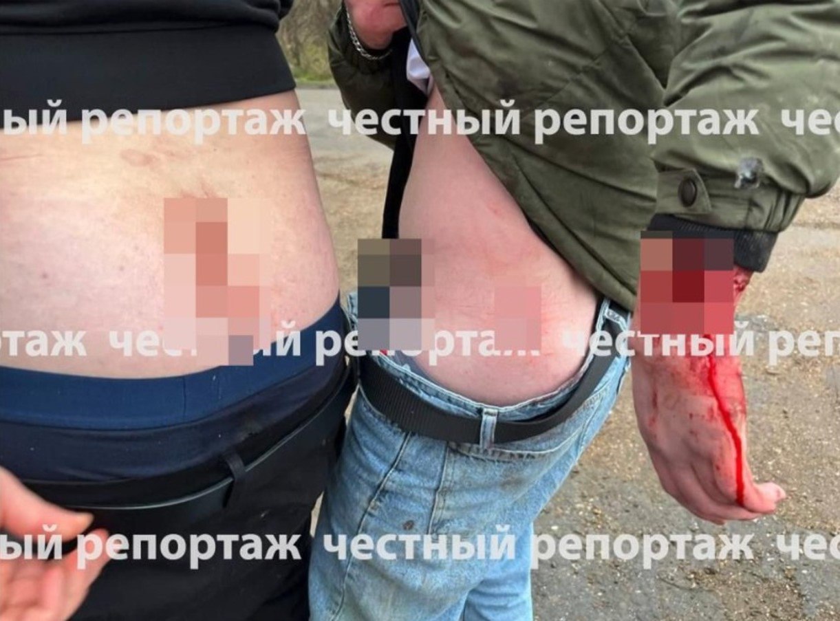Вооруженный конфликт в Кармаскалинском районе Компания друзей приехала на озеро но к ним подошли двое и стали требовать уйти Один из нападавших показал удостоверение похожее на полицейское и начал угрожать оружием В ответ на попытку защититься с помощью камней мужчина применил перцовый баллончик и открыл стрельбу Несколько человек получили тяжелые ранения Стрелком оказался 27 летним представитель общественной организации который получил удостоверение всего несколько дней назад Сейчас проводится проверка Подписывайся на БСТ