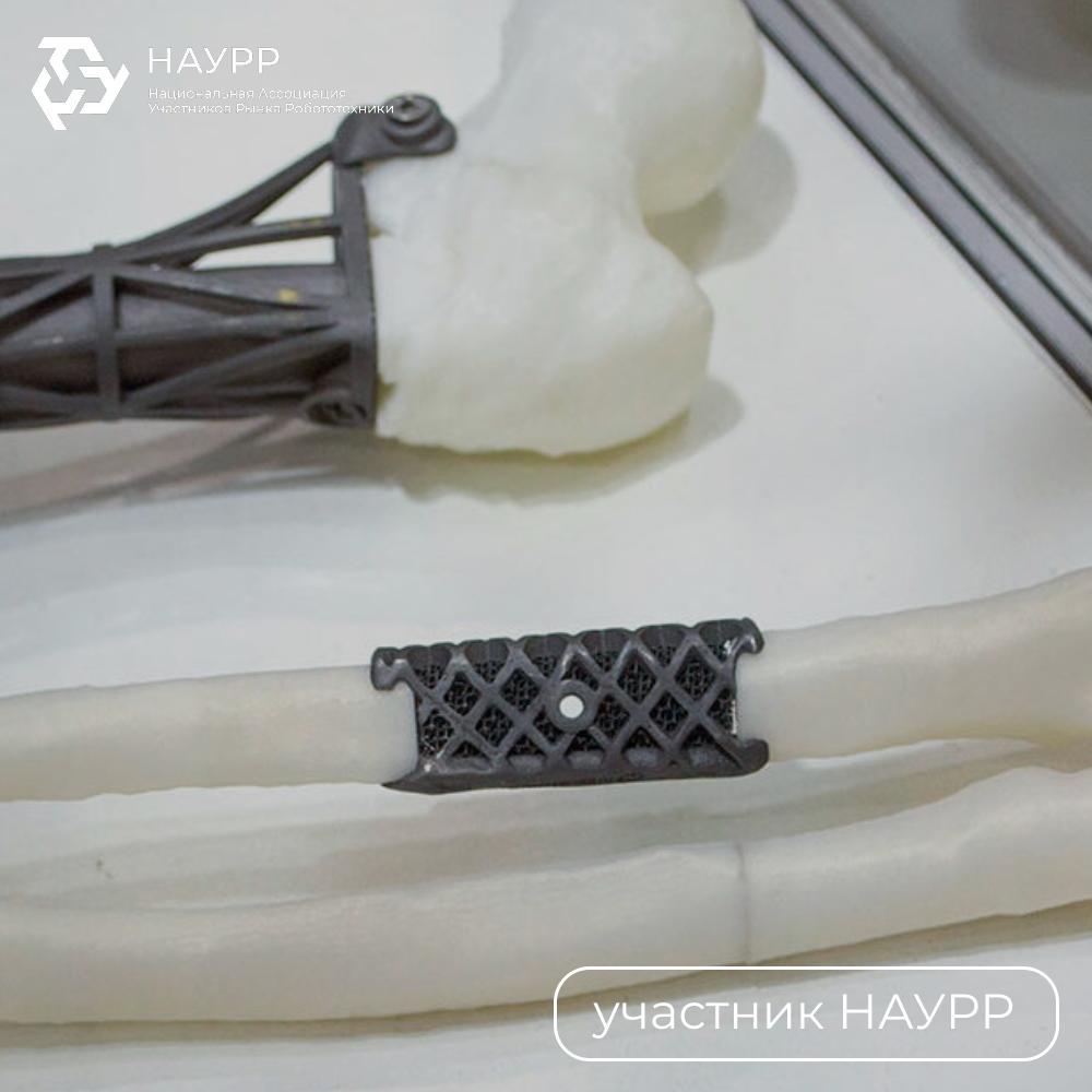 Ученые Пермского политеха создали цифровой конструктор для 3D моделирования имплантатов которые повторяют структуру настоящей кости Программа анализирует данные КТ пациента и подбирает оптимальные параметры пористость толщину и прочность конструкции В результате получаются имплантаты которые не просто приживаются а фактически становятся частью живой ткани Разработка решает главную проблему традиционных скаффолдов несоответствие механических и биологических свойств что часто приводит к осложнениям Сейчас проект готовится к доклиническим испытаниям и уже рассматривается как основа для новых решений в медицине включая челюстно лицевую хирургию и стоматологию Голосовать за канал НАУРР Роботизация и роботы