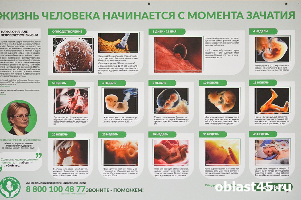 Выплачивать вознаграждение медикам которые отговаривают женщин от абортов из тех же бюджетных лимитов что покрывают процедуру прерывания беременности предложили в правительстве Курганской области Подробности по ссылке