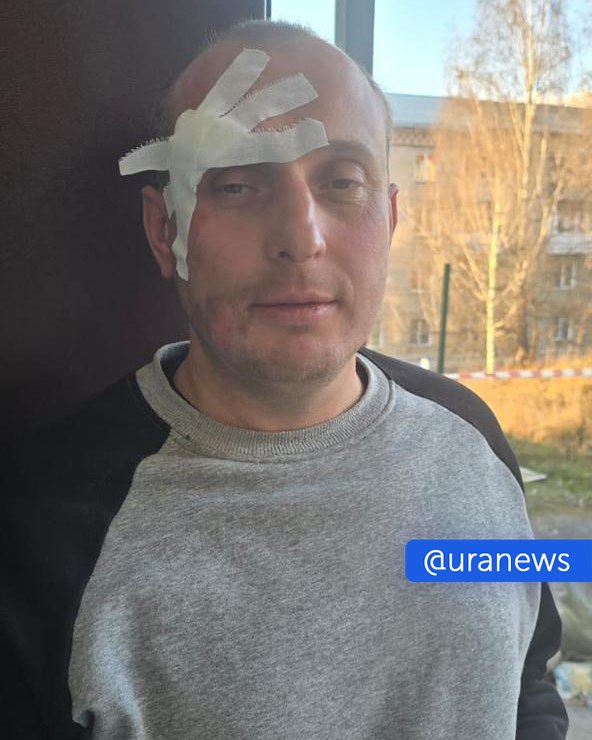 Туриста из Свердловской области избили в челябинском национальном парке Таганай По словам Александра Трофимова агрессоры якобы представились ему сотрудниками минприроды Подробности инцидента рассказал URA RU юрист Сергей Барсуков Трофимов с женой и четырьмя друзьями 25 октября приехали в Таганай поставили машину недалеко от парка и зашли прогуляться в лесной массив Там их остановили представители охраны которые назвались сотрудниками минприроды Они попросили у Трофимова документы он сказал что документы в машине и направился к автомобилю Как только он отвернулся те люди повалили его на землю надели наручники и стали избивать заявил Барсуков Пострадавшего на скорой увезли в больницу Там врачи зашили ему порванную бровь Юрист отметил что Трофимов и его спутники не жгли костры и не мусорили Они решили прогуляться по лесу и предположительно зашли туда куда вход запрещен Туристы утверждают что там не было запрещающих табличек Если гражданин не оказывает сопротивления никто не дает права сковывать его спецсредствами и тем более избивать Думаю данные лица понесут наказание в соответствии с требованиями закона сказал Барсуков UPD 10 28 по мск На территории парка была выявлена группа нарушителей без регистрации Один из них с признаками алкогольного опьянения громко кричал выражался нецензурной бранью На требование сотрудников национального парка прекратить хулиганские действия мужчина не реагировал пытался скрыться и убегая упал и разбил себе бровь прокомментировали случившееся в Таганае Подписаться на URA RU мы в MAX
