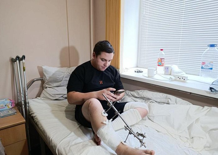 В Челябинске хирурги спасли от ампутации ногу многодетному отцу Хирурги Челябинской областной клинической больницы спасли ногу 24 летнему отцу четырех детей из Верхнего Уфалея Кирилла Перевозчикова доставили в отделение с тяжелейшей травмой после несчастного случая с мотоблоком Для операции потребовалось более 10 человек среди которых были не только травматологи но и пластические хирурги Несчастный случай произошел во время подготовки дачного участка к зиме Из за обрыва ремня устройство буквально зажевало Кириллу ногу Сначала пострадавшего доставили в больницу Верхнего Уфалея где ему оказали первую помощь остановили кровотечение и наложили лангеты Лопасти мотоблока сломали обе кости в голени а также нанесли крупную рваную рану обнажившую мышцы сосуды связки и кости Это мешало восстановлению костей создавало риск заражения и ампутации Чтобы спасти ногу пациента его отправили в ЧОКБ Подписаться на vecherchel   Голосовать за канал