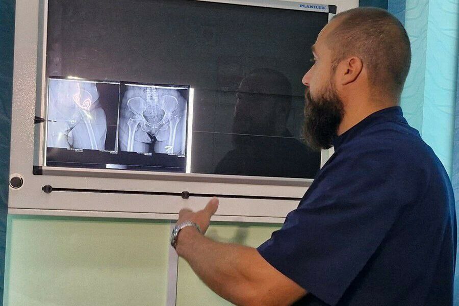 Для жителей Амурской области доступны сложные операции по замене коленных и тазобедренных суставов В Приамурье на базе Амурской областной и Благовещенской городской больниц продолжается реализация госпрограммы бесплатного оказания высокотехнологичных видов медицинской помощи Высоко востребованной в регионе является процедура эндопротезирования В 2025 году на нее запланировано более 700 пациентов Сами протезы сейчас усовершенствованные с напылениями которые нужны для лучшего сращения тканей человека с эндопротезом В среднем срок службы эндопротеза составляет 10 15 лет в зависимости от образа жизни человека лишнего веса и других факторов сообщает минздрав Амурской области Во избежание возможных осложнений уже в первые сутки после операции пациента ставят на ноги В больнице он проводит около недели Реабилитация занимает от трёх до шести месяцев рассказали в министерстве